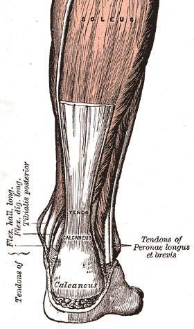 Achilles Tendonitis