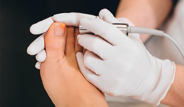 Laser Toenail Fungus Specialists