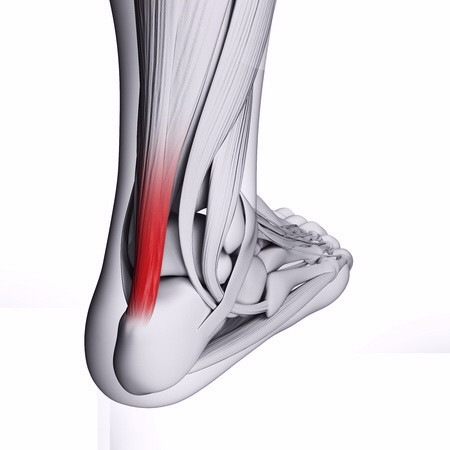 Achilles Tendon